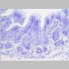 Intestino grueso SF 06.jpg